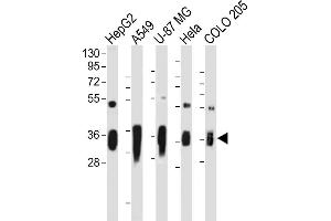 All lanes : Anti-AKR1C2 Antibody (C-term) at 1:2000 dilution Lane 1: HepG2 whole cell lysate Lane 2: A549 whole cell lysate Lane 3: U-87 MG whole cell lysate Lane 4: Hela whole cell lysate Lane 5: COLO 205 whole cell lysate Lysates/proteins at 20 μg per lane. (AKR1C2 Antikörper  (C-Term))