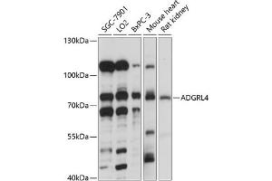 Western blot analysis of extracts of various cell lines, using  antibody (ABIN7266908) at 1:1000 dilution. (ELTD1 Antikörper  (AA 110-406))