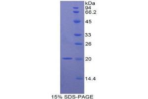 SDS-PAGE (SDS) image for Interleukin 17B (IL17B) (AA 23-180) protein (His tag) (ABIN1879032) (IL17B Protein (AA 23-180) (His tag))