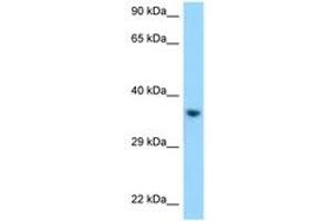 Image no. 1 for anti-Killer Cell Immunoglobulin-Like Receptor, Two Domains, Long Cytoplasmic Tail, 1 (KIR2DL1) (C-Term) antibody (ABIN6748073) (KIR2DL1 Antikörper  (C-Term))