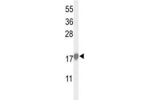 Western blot analysis of p21 antibody and HeLa lysate (p21 Antikörper  (AA 105-140))