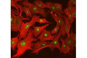 IF analysis of SPT5/SUPT5H using anti-SPT5/SUPT5H antibody (ABIN7601985) and anti-Tubulin beta antibody (ABIN7602744). (SUPT5H Antikörper  (AA 533-1087))