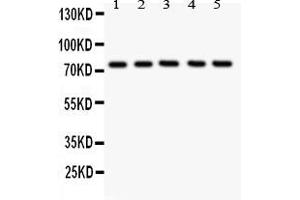 Anti- 12 Lipoxygenase antibody, Western blottingAll lanes: Anti ANOX12  at 0. (ALOX12 Antikörper  (C-Term))
