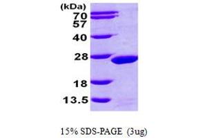 SDS-PAGE (SDS) image for Magnesium-Dependent Phosphatase 1 (MDP1) (AA 1-176) protein (His tag) (ABIN667293)