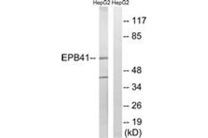 Image no. 1 for anti-Erythrocyte Membrane Protein Band 4.1 (Elliptocytosis 1, RH-Linked) (EPB41) (AA 626-675) antibody (ABIN2889146) (EPB41 Antikörper  (AA 626-675))