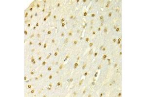Immunohistochemistry of paraffin-embedded rat brain using SFN Antibody. (14-3-3 sigma/SFN Antikörper  (AA 1-248))