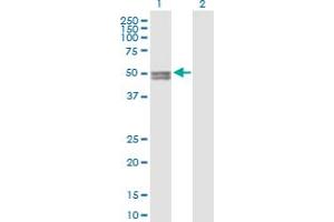 Western Blot analysis of CYP11A1 expression in transfected 293T cell line by CYP11A1 MaxPab polyclonal antibody. (CYP11A1 Antikörper  (AA 1-521))