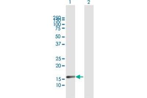 Western Blot analysis of IL20 expression in transfected 293T cell line by IL20 MaxPab polyclonal antibody.
