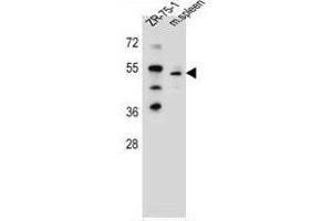 TBX6 Antibody (Center) western blot analysis in ZR-75-1 cell line and mouse spleen tissue lysates (35µg/lane). (T-Box 6 Antikörper  (Middle Region))