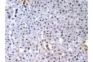 IHC testing of FFPE mouse liver tissue with VEGF Receptor 3 antibody at 1ug/ml. (FLT4 Antikörper)