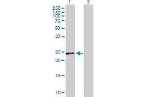 Western Blot analysis of VEGFB expression in transfected 293T cell line by VEGFB MaxPab polyclonal antibody. (VEGFB Antikörper  (AA 1-207))