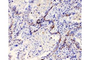 IHC analysis of Integrin alpha 3 using anti-Integrin alpha 3 antibody (ABIN6719410). (ITGA3 Antikörper)