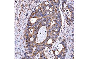 IHC analysis of RAB7/RAB7A using anti-RAB7/RAB7A antibody (ABIN7600597).
