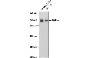 Western blot analysis of extracts of various cell lines, using PHF19 antibody (ABIN6128441, ABIN6145539, ABIN6145540 and ABIN6224090) at 1:1000 dilution. (PHF19 Antikörper  (AA 1-207))
