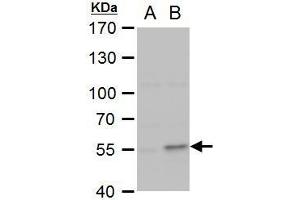 WB Image COL1A2 antibody [C2C3], C-term detects COL1A2 protein by western blot analysis. (COL1A2 Antikörper  (C-Term))