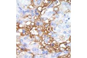 Image no. 2 for anti-Mitogen-Activated Protein Kinase Kinase Kinase Kinase 1 (MAP4K1) (C-Term) antibody (ABIN360390) (MAP4K1 Antikörper  (C-Term))