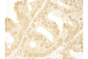 Immunohistochemistry (IHC) image for anti-Ankyrin Repeat Domain 17 (ANKRD17) (AA 1550-1600) antibody (ABIN7448409) (ANKRD17 Antikörper  (AA 1550-1600))