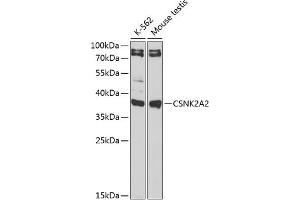 Western blot analysis of extracts of various cell lines, using CSNK2 antibody (ABIN6127663, ABIN6139128, ABIN6139129 and ABIN6217497) at 1:1000 dilution. (CSNK2A2 Antikörper  (AA 1-350))