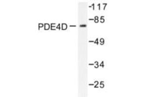 Image no. 1 for anti-phosphodiesterase 4D, cAMP-Specific (PDE4D) antibody (ABIN272057) (PDE4D Antikörper)