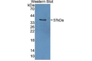 Western blot analysis of the recombinant protein. (GGPS1 Antikörper  (AA 1-290))