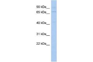 WB Suggested Anti-KLHL3 Antibody Titration: 0. (KLHL3 Antikörper  (N-Term))
