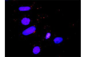 Proximity Ligation Analysis of protein-protein interactions between STAT5B and CTLA4. (STAT5B Antikörper  (AA 1-390))