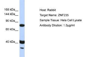 Host: Rabbit Target Name: ZNF235 Sample Type: Hela Whole Cell lysates Antibody Dilution: 1.