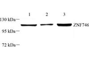 Western blot analysis of PARIS (ABIN7076272) at dilution of 1: 1000,Lane 1: THP-1 cell lysate,Lane 2: SH-SY5Y cell lysate,Lane 3: U251 cell lysate
