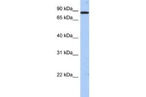 WB Suggested Anti-TMTC1 Antibody Titration:  0. (TMTC1 Antikörper  (Middle Region))