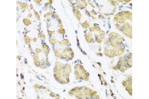 Immunohistochemistry of paraffin-embedded Human stomach using MLN Polyclonal Antibody at dilution of 1:100 (40x lens).