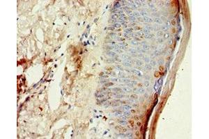 Immunohistochemistry of paraffin-embedded human skin tissue using ABIN7149004 at dilution of 1:100 (CST6 Antikörper  (AA 29-149))