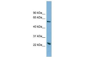 TMEM161A antibody used at 1 ug/ml to detect target protein. (TMEM161A Antikörper  (Middle Region))