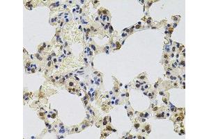 Immunohistochemistry of paraffin-embedded Rat lung using GTF2H2 Polyclonal Antibody at dilution of 1:100 (40x lens).