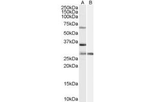 ABIN334465 (1µg/ml) staining of HeLa cell lysate (35µg protein in RIPA buffer) with (B) and without (A) blocking with the immunising peptide. (PRPF31 Antikörper  (Internal Region))
