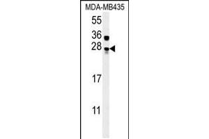 Western blot analysis in MDA-MB435 cell line lysates (15ug/lane). (MUTED Antikörper  (AA 40-68))