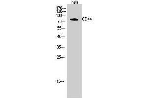 Western Blotting (WB) image for anti-CD44 (CD44) (Ser2152) antibody (ABIN3183773) (CD44 Antikörper  (Ser2152))