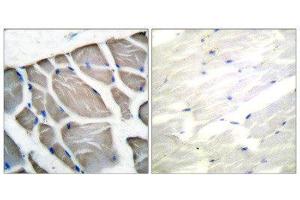 Immunohistochemistry (IHC) image for anti-Actin (pan) antibody (ABIN1848426) (Actin Antikörper  (pan))