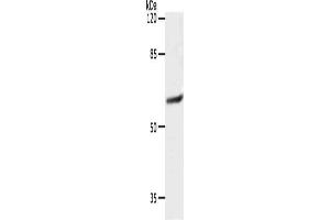 Gel: 10 % SDS-PAGE, Lysate: 40 μg, Lane: 231 cells, Primary antibody: ABIN7192403(SLC16A4 Antibody) at dilution 1/1200, Secondary antibody: Goat anti rabbit IgG at 1/8000 dilution, Exposure time: 10 seconds (SLC16A4 Antikörper)