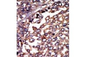 Image no. 2 for anti-Protein Kinase, CAMP-Dependent, Regulatory, Type I, alpha (Tissue Specific Extinguisher 1) (PRKAR1A) (N-Term) antibody (ABIN360569) (PRKAR1A Antikörper  (N-Term))