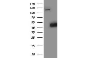 Western Blotting (WB) image for anti-Spermine Synthase, SMS (SMS) antibody (ABIN1501099) (SMS Antikörper)