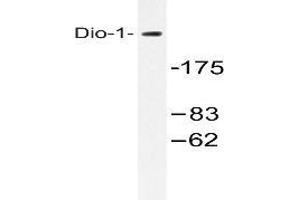 Western blot (WB) analysis with extracts from 293 cells using DIDO1 /  Dio-1 antibody . (DIDO1 Antikörper)