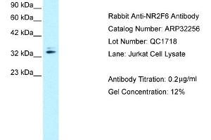 Western Blotting (WB) image for anti-Nuclear Receptor Subfamily 2, Group F, Member 6 (NR2F6) (N-Term) antibody (ABIN2779525) (NR2F6 Antikörper  (N-Term))