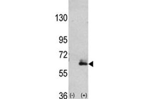 Western blot analysis of anti-MAP2 antibody and 293 cell lysate (2 ug/lane) either nontransfected (Lane 1) or transiently transfected with the hMAP2-Q425 gene (2). (MAP2 Antikörper  (AA 1766-1796))