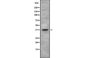 Western blot analysis of TAS2R using 293 whole cell lysates (TBXA2R Antikörper  (C-Term))