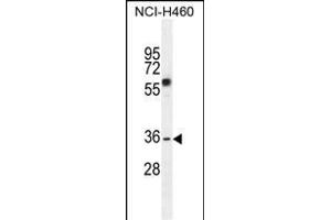 C10orf72 Antibody (Center) (ABIN655143 and ABIN2844765) western blot analysis in NCI- cell line lysates (35 μg/lane). (VSTM4 Antikörper  (AA 142-170))