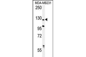 Western blot analysis of PHL Antibody (C-term) (ABIN652395 and ABIN2841923) in MDA-M cell line lysates (35 μg/lane). (PHLPP2 Antikörper  (C-Term))