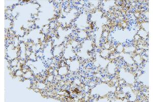 ABIN6275088 at 1/100 staining Mouse lung tissue by IHC-P.