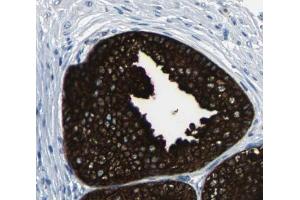 mTOR Antibody for IHC in human prostate tissue (MTOR Antikörper)