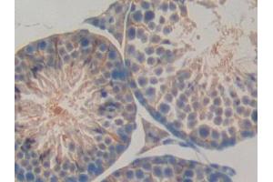 DAB staining on IHC-P; Samples: Mouse Testis Tissue (LBP Antikörper  (AA 25-481))