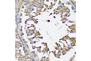 Immunohistochemistry of paraffin-embedded rat testis using LysRS/KARS Rabbit mAb (ABIN7268350) at dilution of 1:100 (40x lens). (KARS Antikörper)